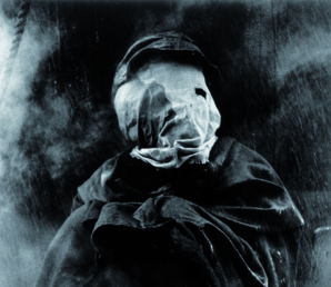 Elephant man